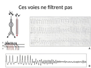 Ces voies ne filtrent pas
 