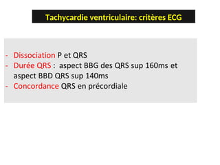 Tachycardie ventriculaire: critères ECG
 
