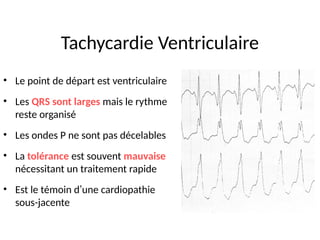 Tachycardie Ventriculaire
• Le point de départ est ventriculaire
• Les QRS sont larges mais le rythme
reste organisé
• Les ondes P ne sont pas décelables
• La tolérance est souvent mauvaise
nécessitant un traitement rapide
• Est le témoin d’une cardiopathie
sous-jacente
 