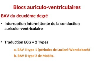Blocs auriculo-ventriculaires
BAV du deuxième degré
• Interruption intermittente de la conduction
auriculo -ventriculaire
• Traduction ECG = 2 Types
a. BAV II type 1 (périodes de Luciani-Wenckebach)
b. BAV II type 2 de Mobitz.
 