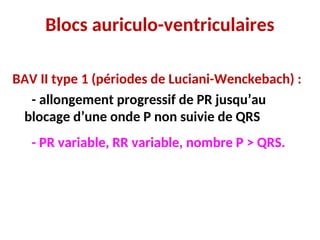 Blocs auriculo-ventriculaires
BAV II type 1 (périodes de Luciani-Wenckebach) :
- allongement progressif de PR jusqu’au
blocage d’une onde P non suivie de QRS
- PR variable, RR variable, nombre P > QRS.
 