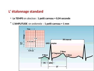 L’ étalonnage standard
• Le TEMPS en abscisse : 1 petit carreau = 0,04 seconde
• L’AMPLITUDE en ordonnée : 1 petit carreau = 1 mm
 