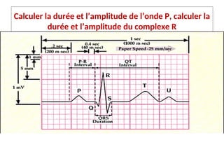 Calculer la durée et l’amplitude de l’onde P, calculer la
durée et l’amplitude du complexe R
 