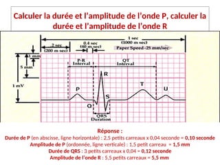 Calculer la durée et l’amplitude de l’onde P, calculer la
durée et l’amplitude de l’onde R
Réponse :
Durée de P (en abscisse, ligne horizontale) : 2,5 petits carreaux x 0,04 seconde = 0,10 seconde
Amplitude de P (ordonnée, ligne verticale) : 1,5 petit carreau = 1,5 mm
Durée de QRS : 3 petits carreaux x 0,04 = 0,12 seconde
Amplitude de l’onde R : 5,5 petits carreaux = 5,5 mm
 