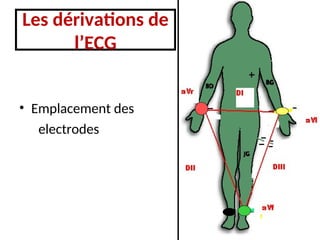 Les dérivations de
l’ECG
• Emplacement des
electrodes
 