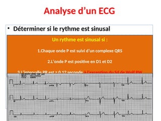 Analyse d’un ECG
• Déterminer si le rythme est sinusal
• Vérifier si le rythme est régulier ou irrégulier
• Calculer la fréquence cardiaque
• Calculer l’axe électrique du complexe QRS
• Analyser : onde P, intervalle PR, complexe QRS,
segment ST, onde T
Un rythme est sinusal si :
1.Chaque onde P est suivi d’un complexe QRS
2.L’onde P est positive en D1 et D2
3.L’intervalle PR est ≥ 0,12 seconde à l’exception du Sd de Wolf PW
 