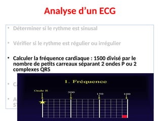 Analyse d’un ECG
• Déterminer si le rythme est sinusal
• Vérifier si le rythme est régulier ou irrégulier
• Calculer la fréquence cardiaque : 1500 divisé par le
nombre de petits carreaux séparant 2 ondes P ou 2
complexes QRS
• Calculer l’axe électrique du complexe QRS
• Analyser : onde P, intervalle PR, complexe QRS, segment
ST, onde T
 