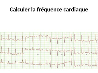 Calculer la fréquence cardiaque
 