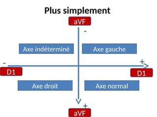 Plus simplement
aVF
aVF
D1 D1
-
- +
+
Axe gauche
Axe normal
Axe indéterminé
Axe droit
 