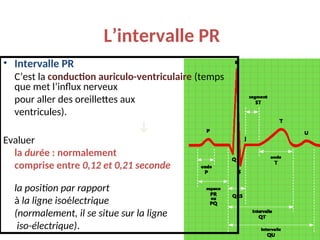L’intervalle PR
• Intervalle PR
C’est la conduction auriculo-ventriculaire (temps
que met l’influx nerveux
pour aller des oreillettes aux
ventricules).
↓
Evaluer
la durée : normalement
comprise entre 0,12 et 0,21 seconde
la position par rapport
à la ligne isoélectrique
(normalement, il se situe sur la ligne
iso-électrique).
 