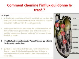 Comment chemine l’influx qui donne le
tracé ?
Les étapes :
1. Activation du nœud sinusal de Keith et Flack qui est situé à la
partie haute de l’oreillette droite (cette activation n’a pas de
traduction visible sur l’électrocardiogramme) ;
2. Puis dépolarisation (ou activation) des oreillettes qui se fait
de la droite vers la gauche et de haut en bas (à cause de la
position anatomique du pace maker qu’est le nœud sinusal
de Keith et Flack) ;
3. Puis l’influx traverse le nœud d’Aschoff Tawara qui ralentit
la vitesse de conduction ;
4. Quittant le nœud d’Aschoff Tawara, l’activation chemine
dans le réseau de HIs-Purkinje dépolarisant d’abord le
septum interventriculaire puis de façon simultanée les 2
ventricules.
1 2
3
4
 
