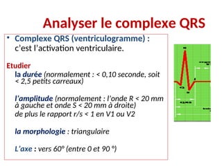 Analyser le complexe QRS
• Complexe QRS (ventriculogramme) :
c’est l’activation ventriculaire.
Etudier
la durée (normalement : < 0,10 seconde, soit
< 2,5 petits carreaux)
l’amplitude (normalement : l’onde R < 20 mm
à gauche et onde S < 20 mm à droite)
de plus le rapport r/s < 1 en V1 ou V2
la morphologie : triangulaire
L’axe : vers 60° (entre 0 et 90 °)
 