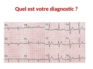 Quel est votre diagnostic ?
 