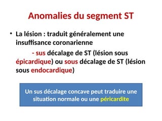 Anomalies du segment ST
• La lésion : traduit généralement une
insuffisance coronarienne
- sus décalage de ST (lésion sous
épicardique) ou sous décalage de ST (lésion
sous endocardique)
Un sus décalage concave peut traduire une
situation normale ou une péricardite
 