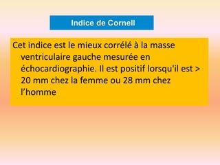 Cet indice est le mieux corrélé à la masse
ventriculaire gauche mesurée en
échocardiographie. Il est positif lorsqu'il est >
20 mm chez la femme ou 28 mm chez
l’homme

 