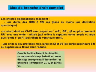 Bloc de branche droit complet

Les critères diagnostiques associent :
- une durée des QRS ≥ 120 ms (dans au moins une dérivation
quelconque)
-un retard droit en V1-V2 avec aspect rsr’, rsR', rSR’, qR ou plus rarement
RR' avec une onde r initiale (qui reflète le septum) moins ample et large
que l’onde r’ ou R’ (qui reflète le ventricule droit).
- une onde S peu profonde mais large en DI et V6 (de durée supérieure à R
ou supérieure à 40 ms chez l’adulte)
On note habituellement des troubles
secondaires de la repolarisation : sousdécalage du segment ST descendant et
une onde T inversée en V1-V2 et parfois
V3.

 
