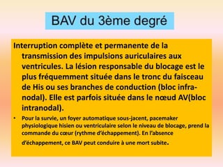 Interruption complète et permanente de la
transmission des impulsions auriculaires aux
ventricules. La lésion responsable du blocage est le
plus fréquemment située dans le tronc du faisceau
de His ou ses branches de conduction (bloc infranodal). Elle est parfois située dans le nœud AV(bloc
intranodal).
• Pour la survie, un foyer automatique sous-jacent, pacemaker
physiologique hisien ou ventriculaire selon le niveau de blocage, prend la
commande du cœur (rythme d’échappement). En l’absence
d’échappement, ce BAV peut conduire à une mort subite.

 