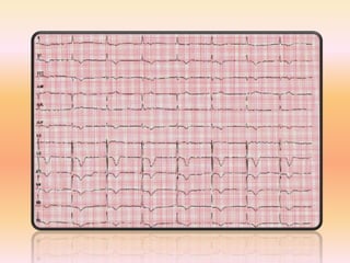 ECG formation accélérée