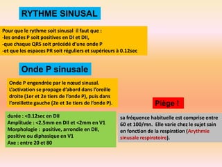 RYTHME SINUSAL
Pour que le rythme soit sinusal il faut que :
-les ondes P soit positives en DI et DII,
-que chaque QRS soit précédé d’une onde P
-et que les espaces PR soit réguliers et supérieurs à 0.12sec

Onde P sinusale
Onde P engendrée par le nœud sinusal.
L’activation se propage d’abord dans l’oreille
droite (1er et 2e tiers de l’onde P), puis dans
l’oreillette gauche (2e et 3e tiers de l’onde P).
durée : <0.12sec en DII
Amplitude : <2.5mm en DII et <2mm en V1
Morphologie : positive, arrondie en DII,
positive ou diphasique en V1
Axe : entre 20 et 80

Piège !
sa fréquence habituelle est comprise entre
60 et 100/mn. Elle varie chez le sujet sain
en fonction de la respiration (Arythmie
sinusale respiratoire).

 