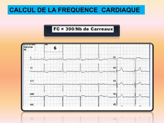 CALCUL DE LA FREQUENCE CARDIAQUE

 