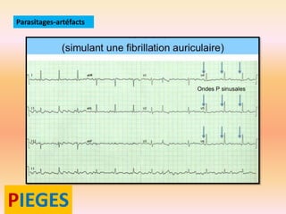 Parasitages-artéfacts

PIEGES

 