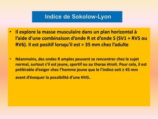 • Il explore la masse musculaire dans un plan horizontal à
l’aide d’une combinaison d’onde R et d’onde S (SV1 + RV5 ou
RV6). Il est positif lorsqu'il est > 35 mm chez l’adulte
• Néanmoins, des ondes R amples peuvent se rencontrer chez le sujet
normal, surtout s’il est jeune, sportif ou au thorax étroit. Pour cela, il est
préférable d’exiger chez l’homme jeune que le l’indice soit ≥ 45 mm
avant d’évoquer la possibilité d’une HVG.

 