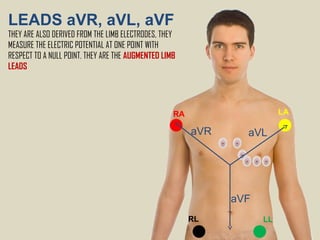 ecg for noob ecg interpretation ecg recall | PPT