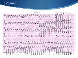 Don’t miss this…
 