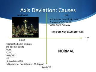 V TACH!!!
Axis Deviation: Causes
NORMAL
Northwest LEFT
RIGHT
Lead
I
Lead aVF
•normal finding in children
and tall thin adults
•RVH
•COPD
•ASD/VSD
•PE
•Anterolateral MI
•left posterior hemiblock (>125 degree)
•left anterior hemiblock (>-45o
)
•Q waves of inferior MI
•WPW-Right Pathway
LVH DOES NOT CAUSE LEFT AXIS
 