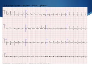 Pt 8: 43 yo female complains of chest tightness
 