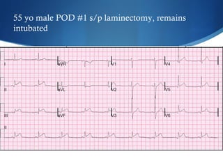 55 yo male POD #1 s/p laminectomy, remains
intubated
 
