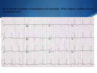 25 yo female complains of palpitations and dizziness. What imaging modality should
be ordered next?
 