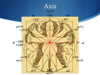 Axis
 