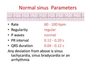 ECG details- for Students | PDF