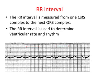 ECG details- for Students | PDF