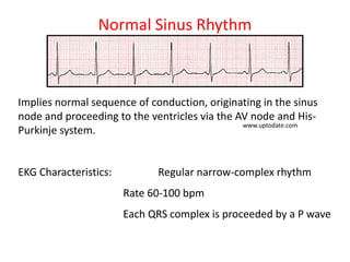 ECG details- for Students | PDF