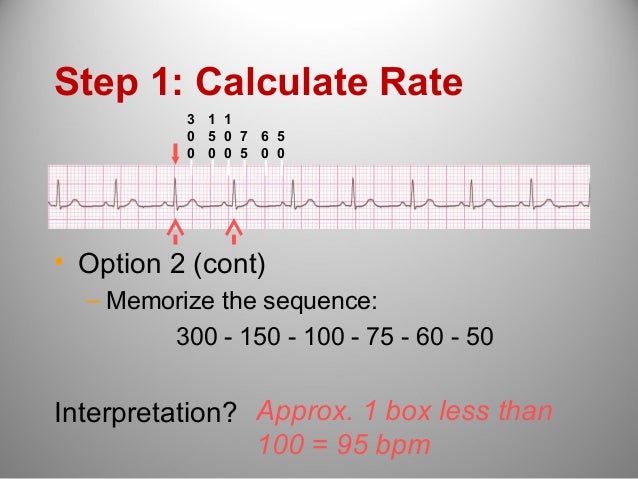 Ecg From Alpha To Omega Ecg From Alpha To Omega