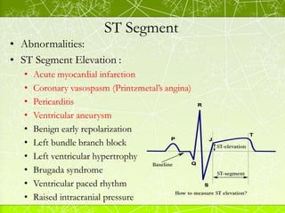 Segmen St Ecg fundamentals | PDF