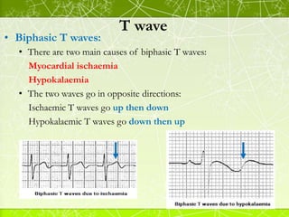Ecg fundamentals | PDF