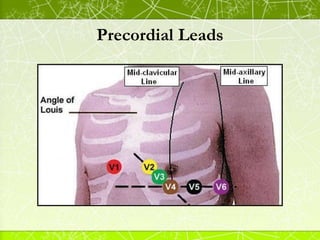 Precordial Leads
 