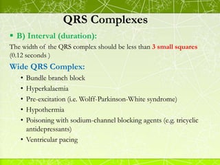 QRS Complexes
Right Bundle Branch Block ( R.B.B.B )
 Criteria:
• Broad QRS ≥ 0.12 sec ( 3 small squares )
• rsR’ with pro...