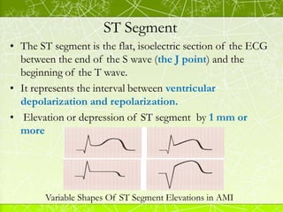 ST Segment
• Abnormalities:
• ST Segment Elevation :
• Acute myocardial infarction
• Coronary vasospasm (Printzmetal’s ang...