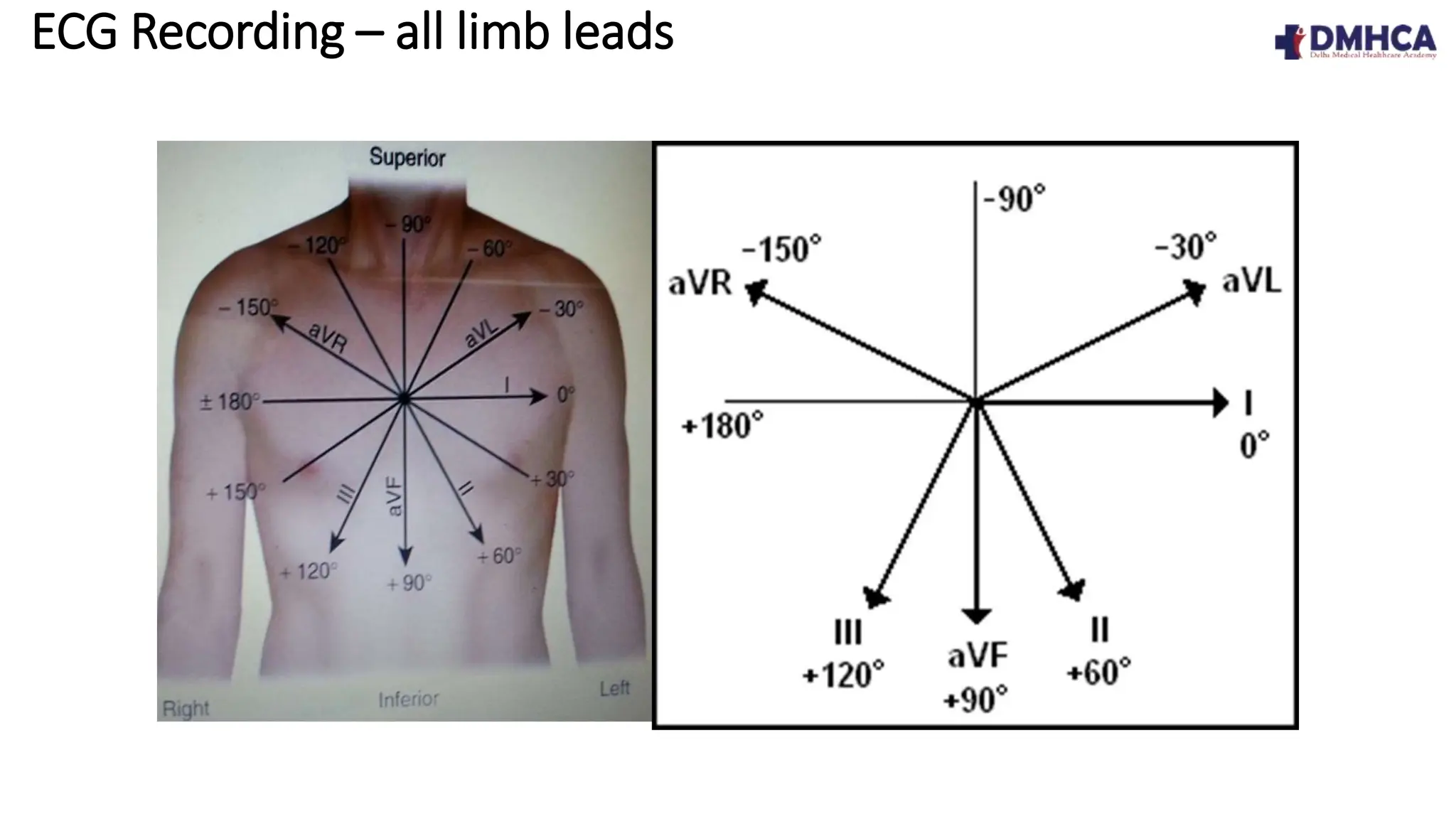 Ecg Example Teaching ECG Fundamentals.pptx