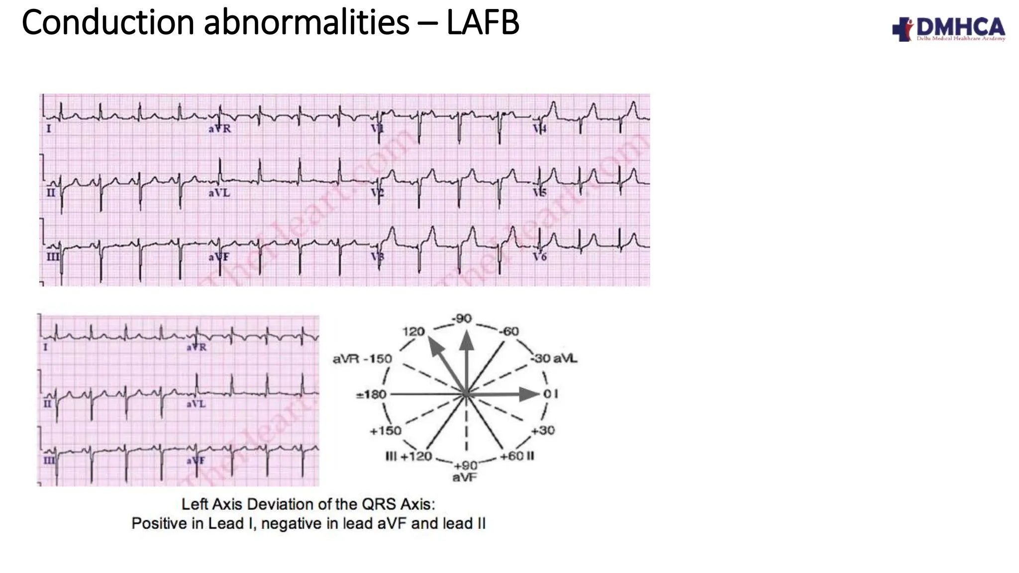 ECG Fundamentals.pptx