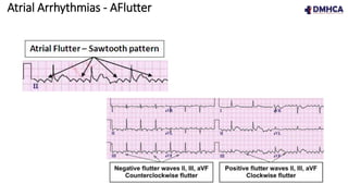 ECG Fundamentals.pptx