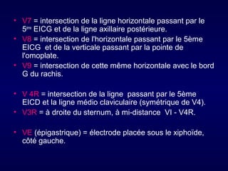 • V7 = intersection de la ligne horizontale passant par le
5ème EICG et de la ligne axillaire postérieure.
• V8 = intersection de l'horizontale passant par le 5ème
EICG et de la verticale passant par la pointe de
l'omoplate.
• V9 = intersection de cette même horizontale avec le bord
G du rachis.
• V 4R = intersection de la ligne passant par le 5ème
EICD et la ligne médio claviculaire (symétrique de V4).
• V3R = à droite du sternum, à mi-distance VI - V4R.
• VE (épigastrique) = électrode placée sous le xiphoïde,
côté gauche.

 