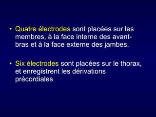 • Quatre électrodes sont placées sur les
membres, à la face interne des avantbras et à la face externe des jambes.
• Six électrodes sont placées sur le thorax,
et enregistrent les dérivations
précordiales

 