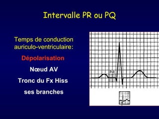 Intervalle PR ou PQ
Temps de conduction
auriculo-ventriculaire:
Dépolarisation
Nœud AV
Tronc du Fx Hiss
ses branches

 