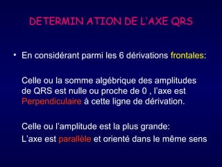 DETERMIN ATION DE L’AXE QRS
• En considérant parmi les 6 dérivations frontales:
Celle ou la somme algébrique des amplitudes
de QRS est nulle ou proche de 0 , l’axe est
Perpendiculaire à cette ligne de dérivation.
Celle ou l’amplitude est la plus grande:
L’axe est parallèle et orienté dans le même sens

 