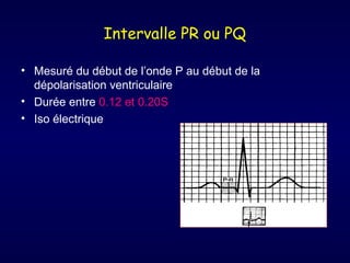 Intervalle PR ou PQ
• Mesuré du début de l’onde P au début de la
dépolarisation ventriculaire
• Durée entre 0.12 et 0.20S
• Iso électrique

 